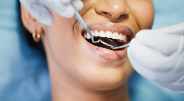 Best Knocked-Out Tooth Emergency  in Greenwich, OH