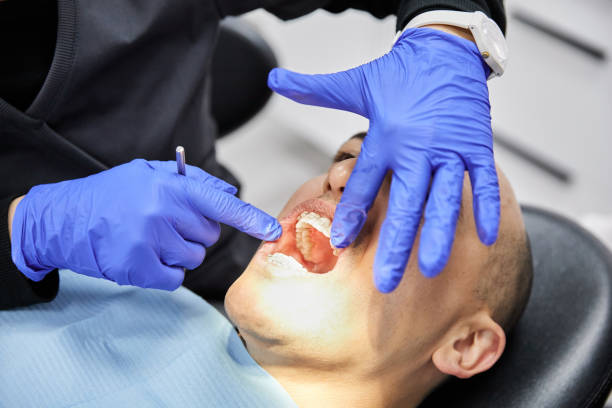 Best Knocked-Out Tooth Emergency  in Greenwich, OH